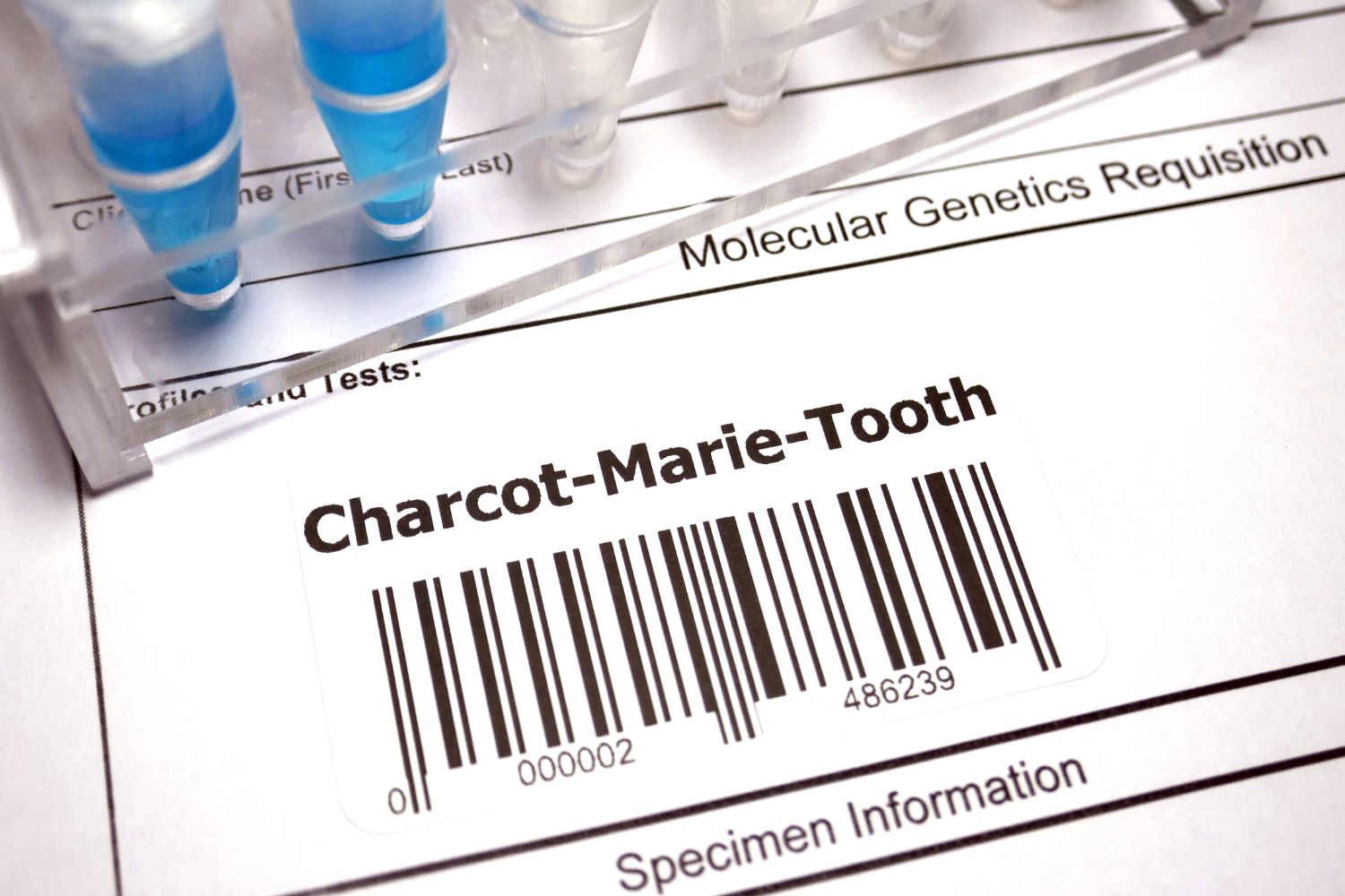 Foto de un código de barras para ilustrar un artículo sobre Charcot-Marie-Tooth